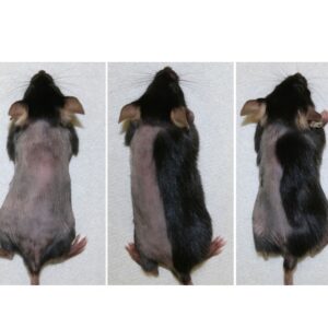 jak inhibitors for treating hair loss