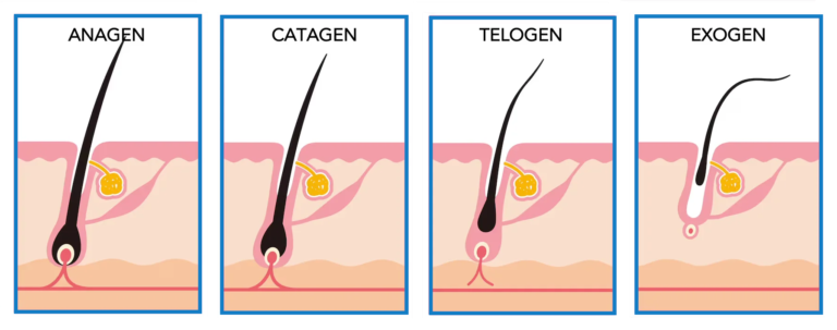 Stages of the hair growth cycle showing anogen, catagen, and telogen phases at Hairloss-Recovery