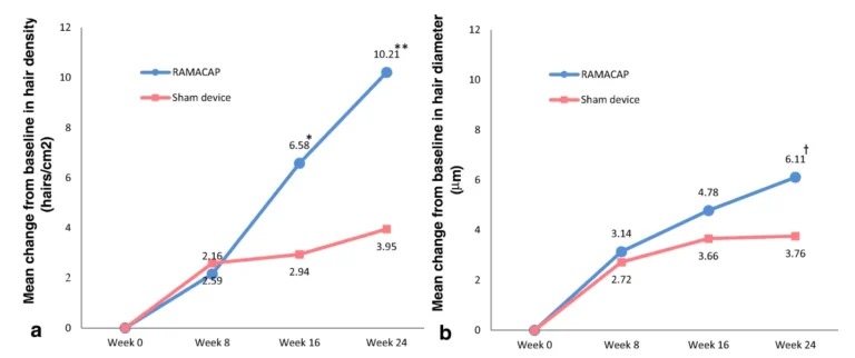 Clinical trial results of low-level laser therapy (LLLT) to treat hair loss compared with a placebo