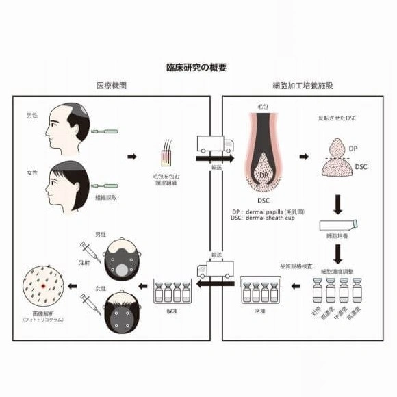 Shiseido's phase 3 trials for hair growth research Shiseido