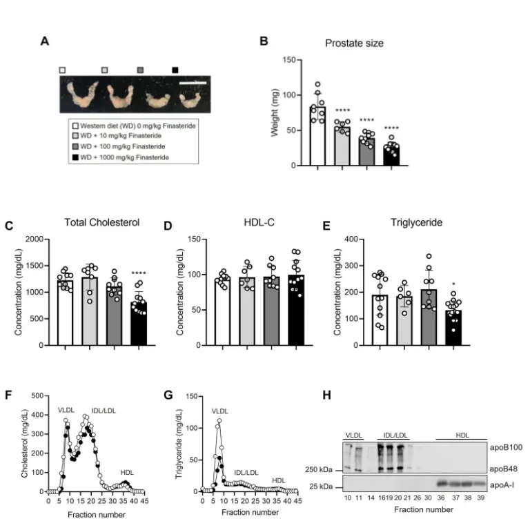 cardiovascular benefits of finasteride leading to lower cholesterol