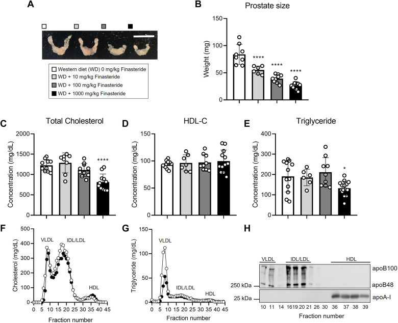 study results showing that finasteride may lead to lower cholesterol