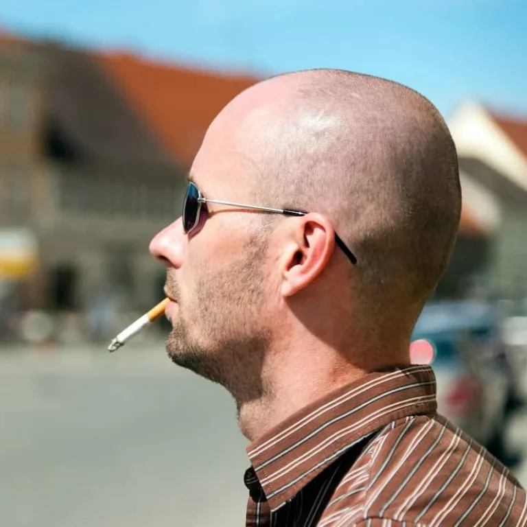 bald man smoking a cigarette showing a link between smoking and hair loss