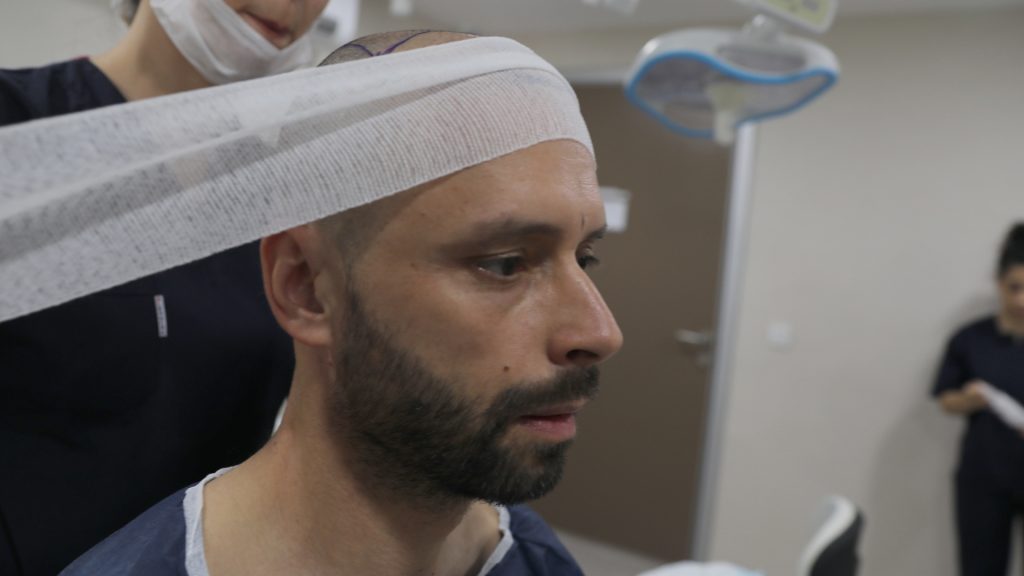 post operative hair transplant care with a bandage being placed over the transplant