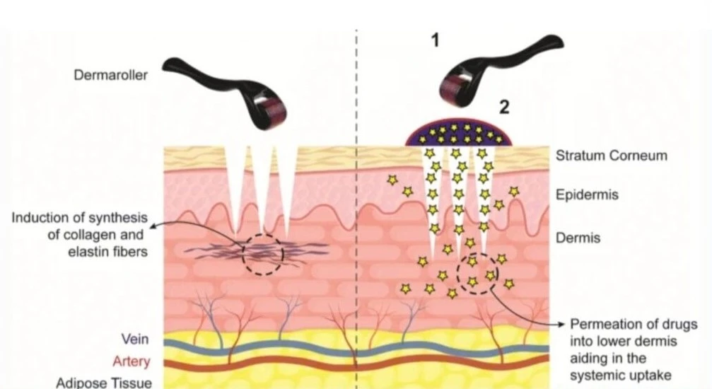 how dermarollers work diagram