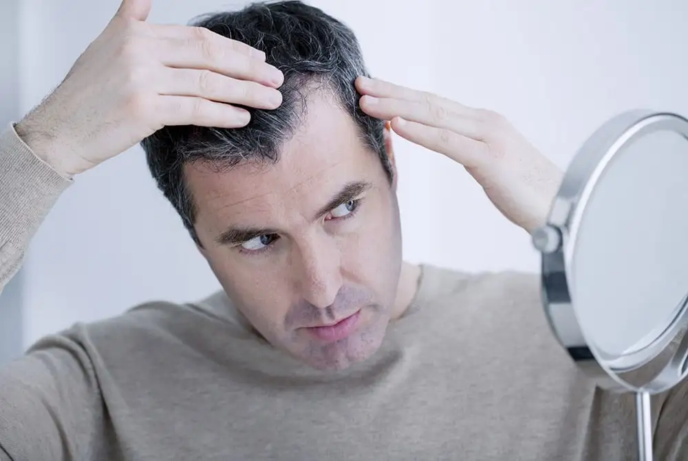 hair loss in middle aged men