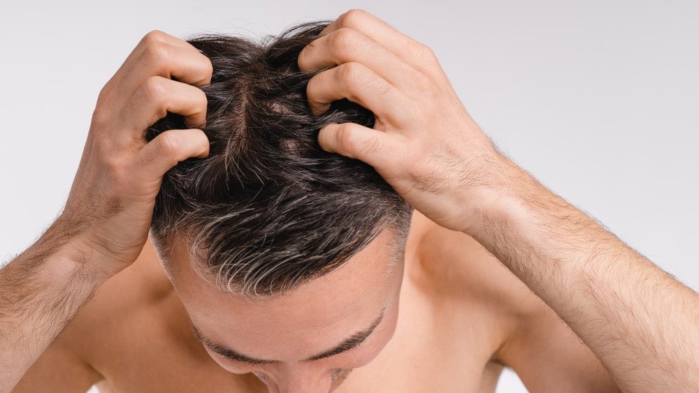 man-stressed-out-about-his-hair-loss at hairloss-recovery