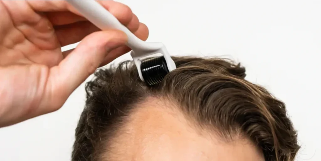 young man using non-fda approved hair loss treatments like dermarolling