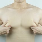 man shows of gyno (gynecomastia) from finasteride