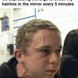 Bald meme with anxiety laughter