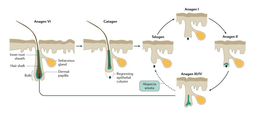 hair growth cycle with alopecia areata blocking the