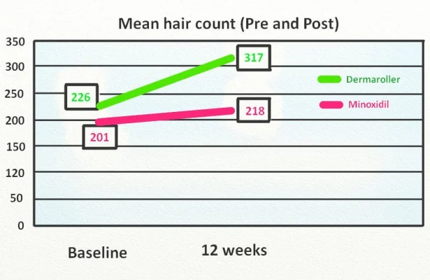 Chart showing improvement with minoxidil and dermarolling after 12 weeks