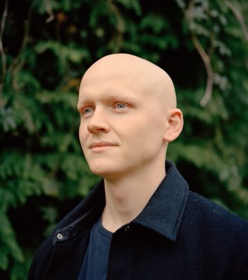 man with alopecia totalis showing no hair on his scalp