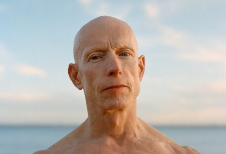 shirtless man with alopecia universalis